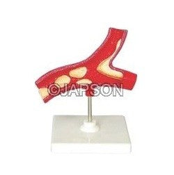 Human Lymph Node Human Lymph Node